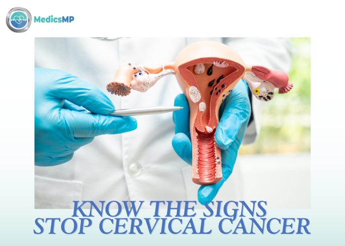 Cervical Cancer: Symptoms, Causes, and Prevention